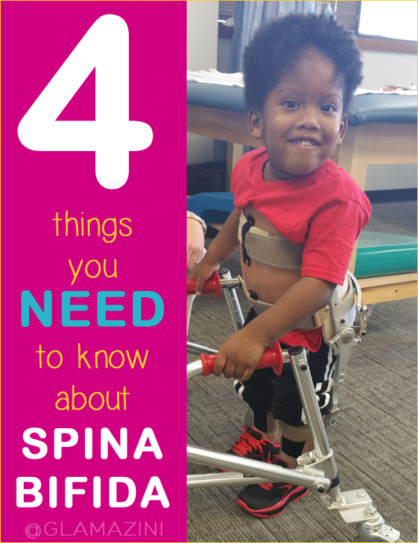 4 things you need to know about spina bifida