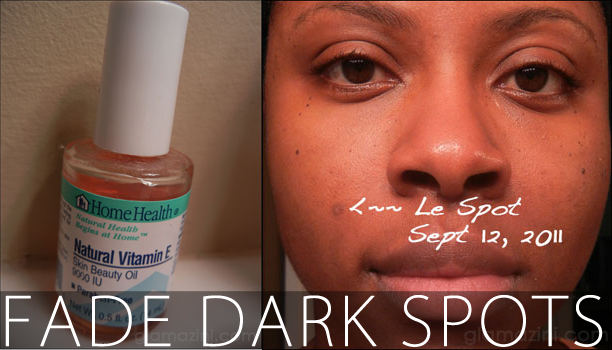 Using Vitamin E Oil To Fade Hyperpigmentation Glamazini